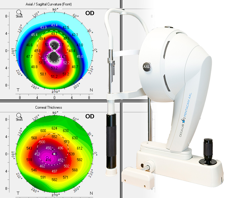 pentacam with map