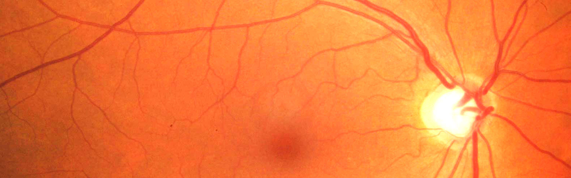eye microscope view