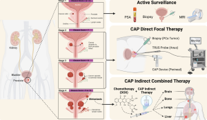 Image for Cold Atmospheric Plasma for Prostate Cancer Therapy