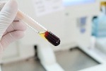 Clotted blood with serum in test tube laboratory background