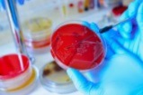 Scientist using a petri dish in a microbiological laboratory